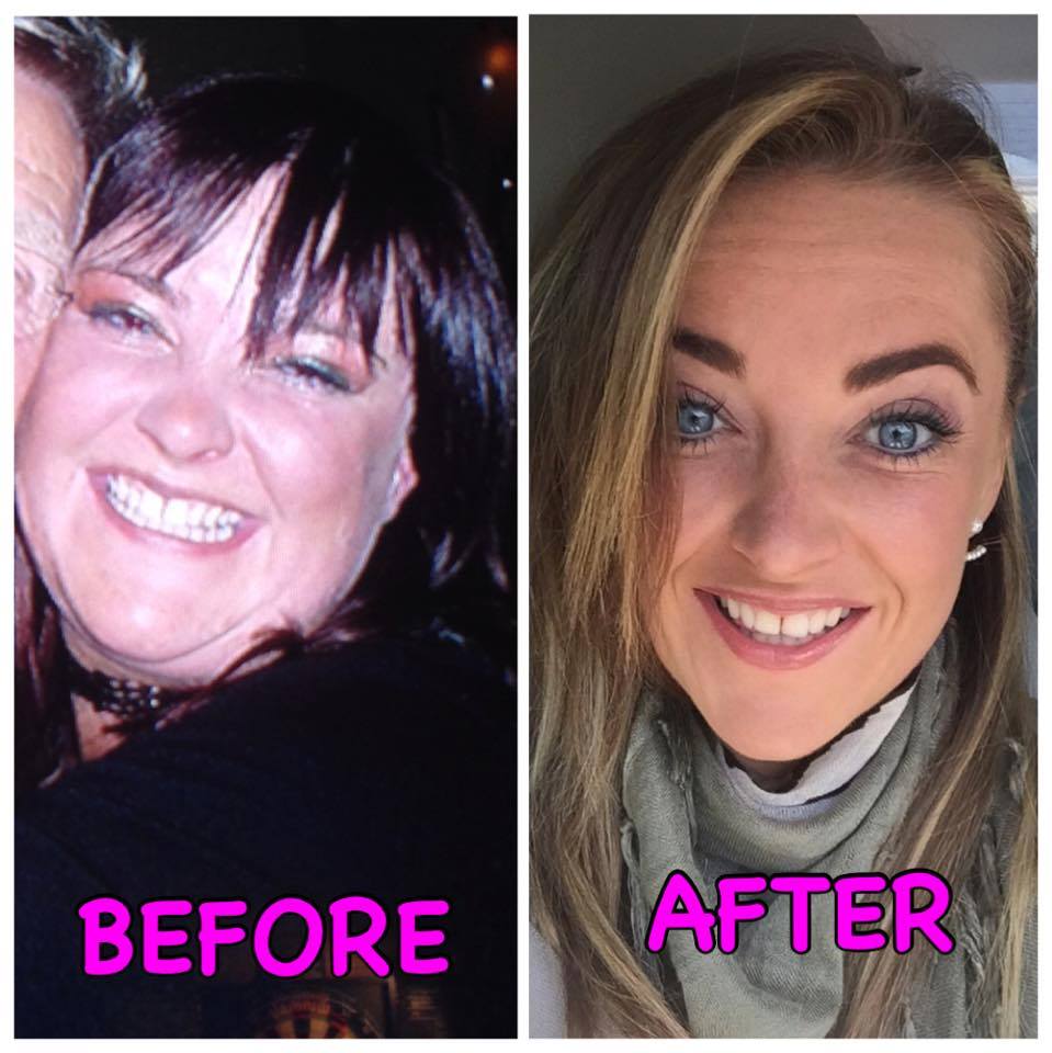 New You Plan before and after photos